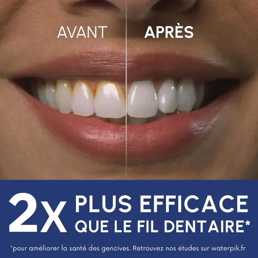 71CvXiMf97L._AC_SL1500_