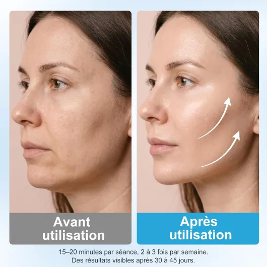 Masseur Cellulite 40K, Machine Minceur 4 En 1, Ultrasons Cavitation Radiofréquencemètre, Machine De Beauté Visage Et Corps Pour Raffermir Et Modélisation Peau Raffermissante Blanc