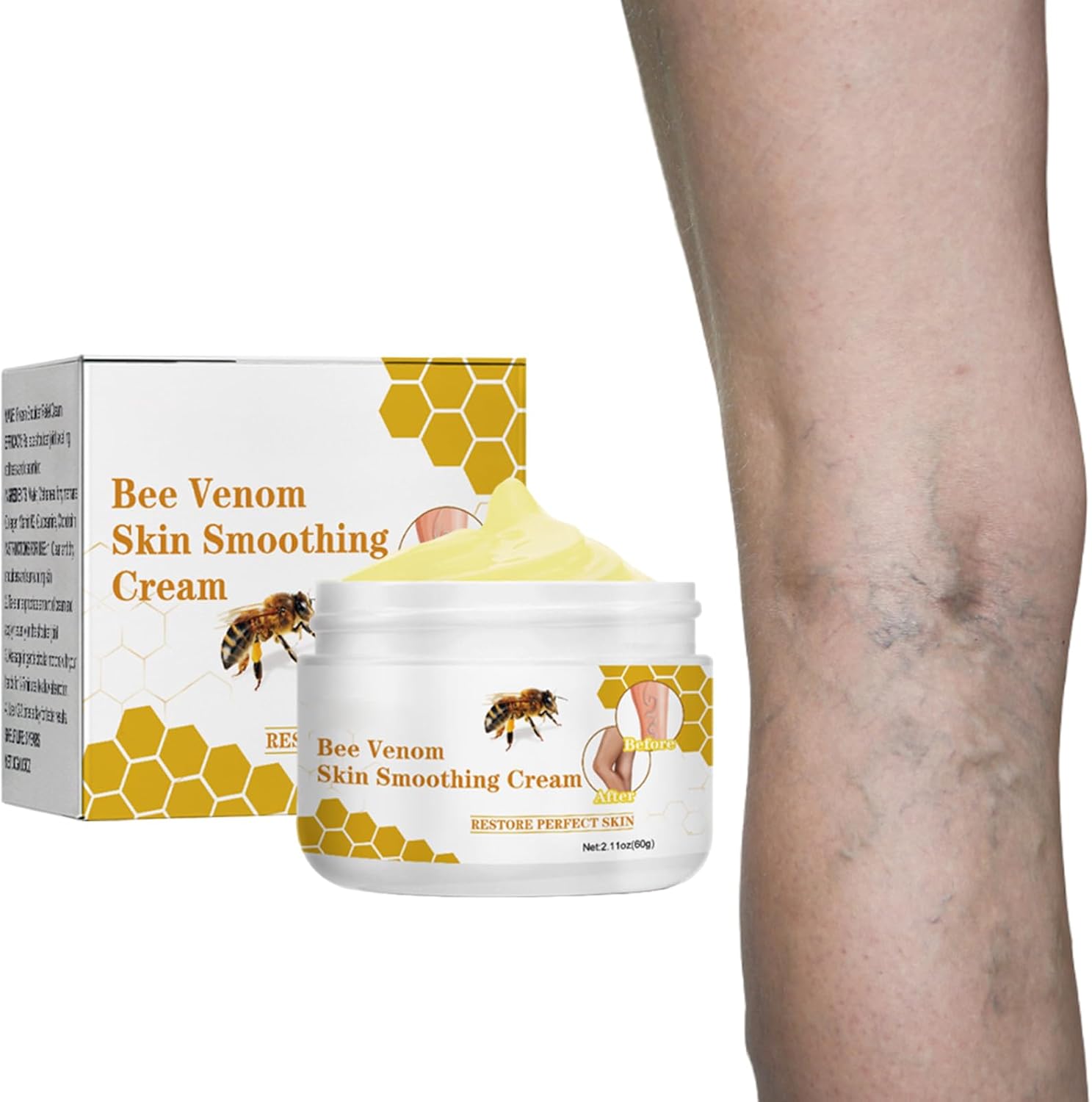 Crème pour Contre les Varices au Venin d'Abeille, Crème de Traitement des Varices au Venin d'abeille, Pommade de Récupération au Venin d'abeille pour les Jambes, Convient à Tous Les Types De Peau, 60g 1*60g