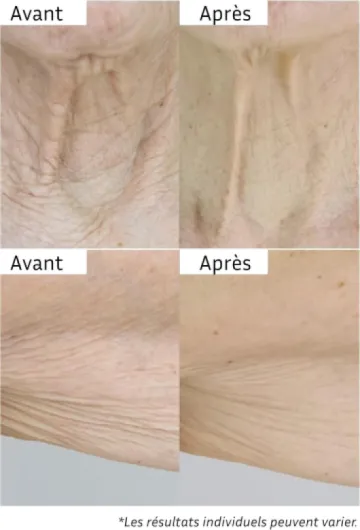 71VvvCii98L._AC_SL1500_