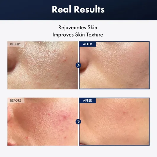 719GqrLNAoL._AC_SL1500_