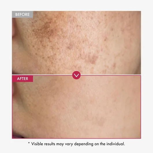 71M7TeN7sHL._AC_SL1500_