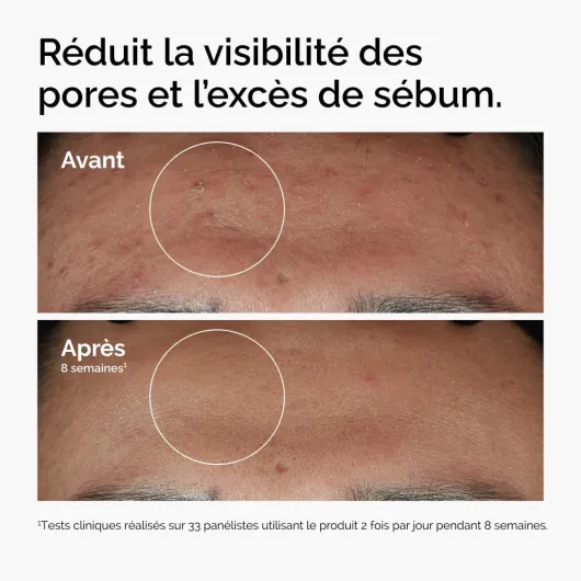 619Tu7uKR4L._AC_SL1080_