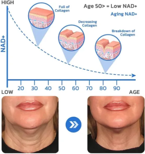 617BDM-VBjL._AC_SL1001_