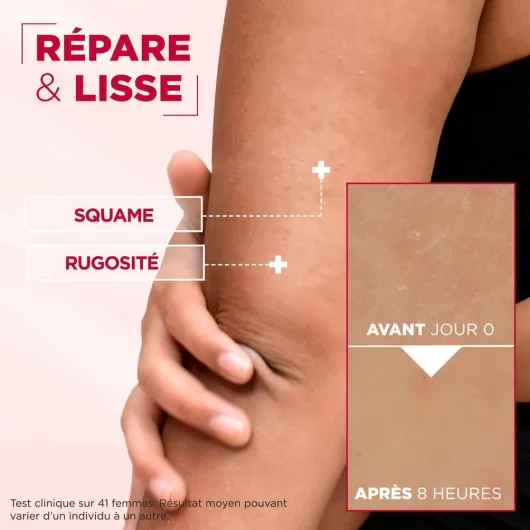 61 TZz9E8HL._AC_SL1004_