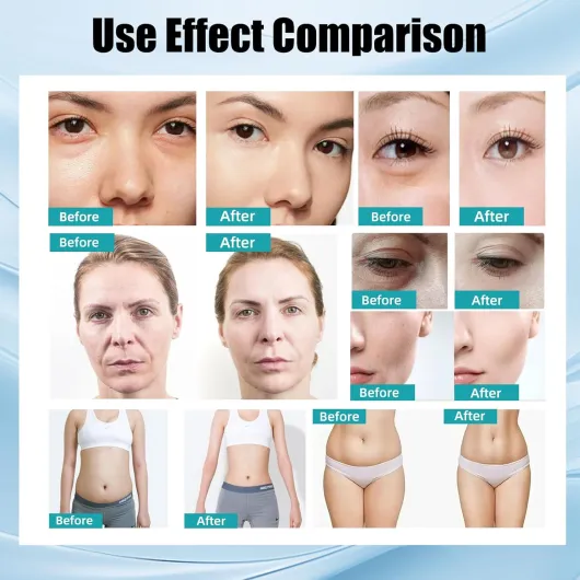 40K Corps Amincissant Machine,Masseur Anti Cellulite Appareil Minceur,4 en 1 Lipocavitation Radiofréquence Visage et Corps Entier Masseur Amincissants,Machine De Beauté Du Visage