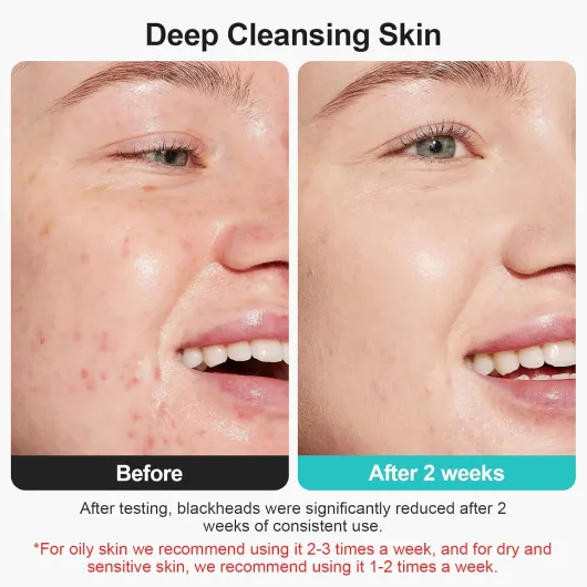 81tBpZfXtLL._AC_SL1500_