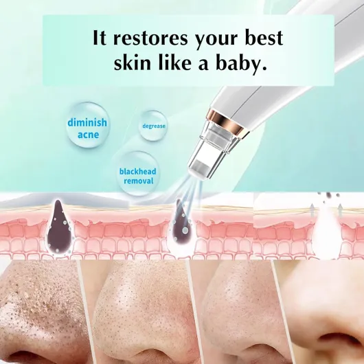 71wkSxiAJfL._AC_SL1500_