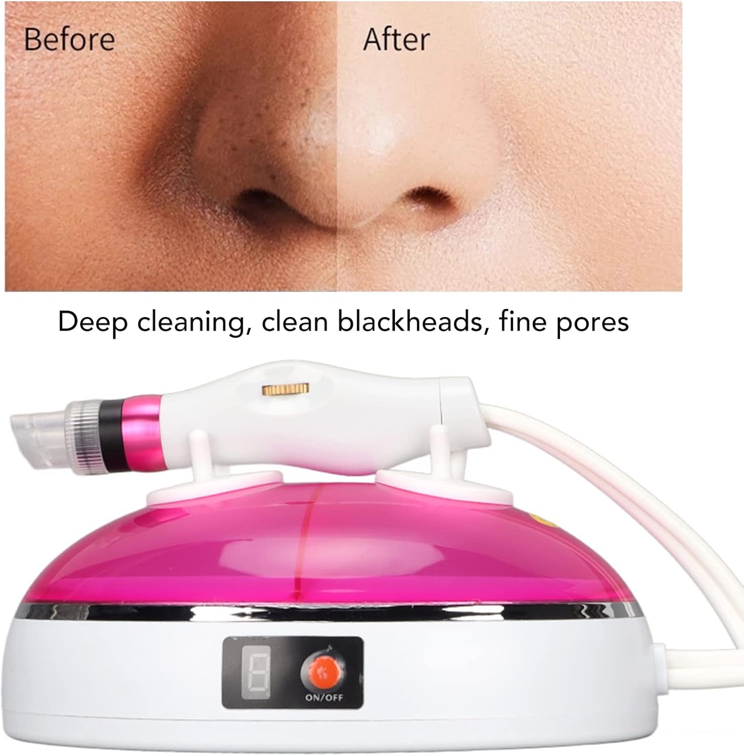 Aspirateur de pores pour points noirs, 3 puissances d'aspiration, 8 sondes, kit d'aspirateur de points noirs rechargeable par USB, outil d'extraction électrique pour nettoyeur de