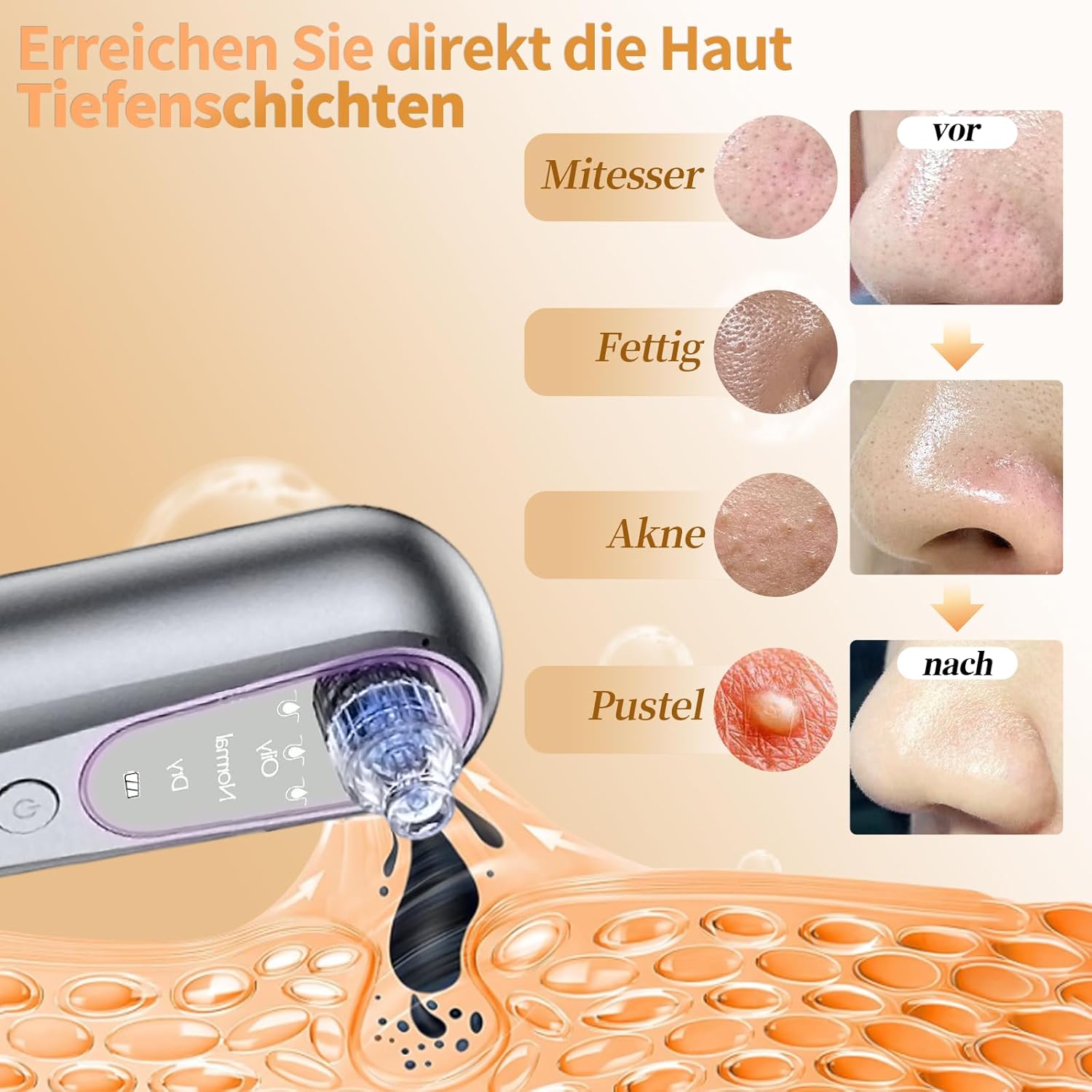 Aspirateur Point Noir Professionnel, Extracteur Point Noir Electrique,Anti Point Noir Nez Nettoyage des Pore, Tire Comedon Points Noirs avec 5 Têtes et 3 Mode, Rechargeable USB