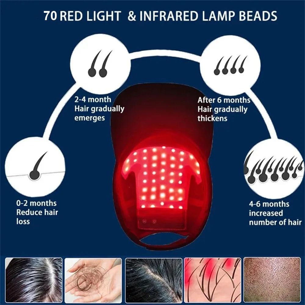 Casque De Croissance Des Cheveux, 630 Nm, 650 Nm, 470 Nm, LumièRe Rouge Et Bleue, 4 Modes, Massage Par Vibration, 70 Led, Pour Favorise La Repousse Rapide Des Cheveux, Pour Hommes Et Femmes