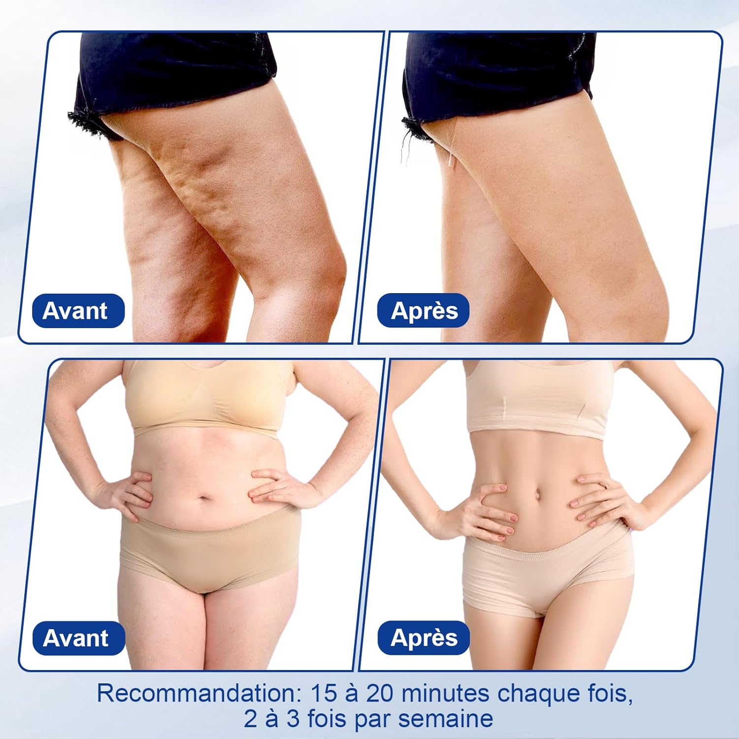 3 EN 1 Radiofréquence Visage, 40K Appareil Anti Cellulite Lipocavitation Radiofréquence Visage et Corps, Ventouse Cellulite Entier Masseur Amincissants et Raffermissants Blanc