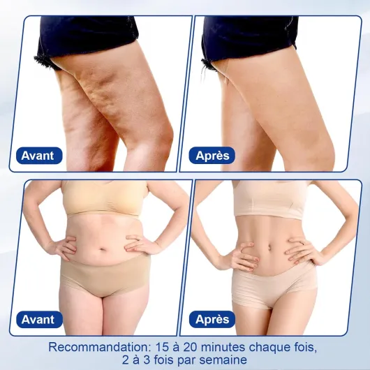 3 EN 1 Radiofréquence Visage, 40K Appareil Anti Cellulite Lipocavitation Radiofréquence Visage et Corps, Ventouse Cellulite Entier Masseur Amincissants et Raffermissants Blanc