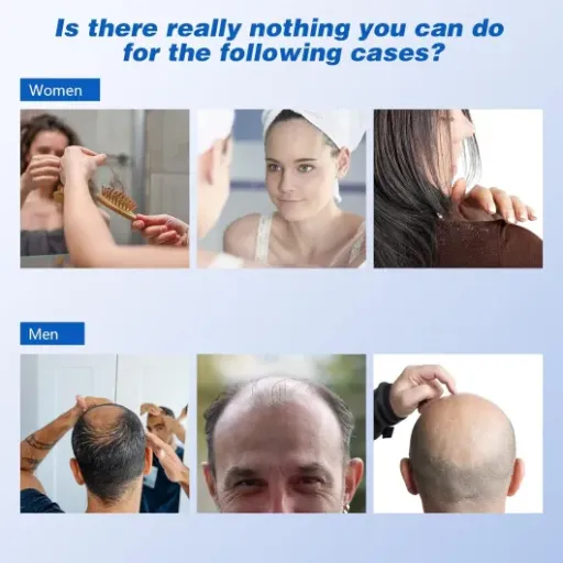 Test KTS Casque de Croissance de Cheveux : gadget cher ou vraie aide contre la chute ?