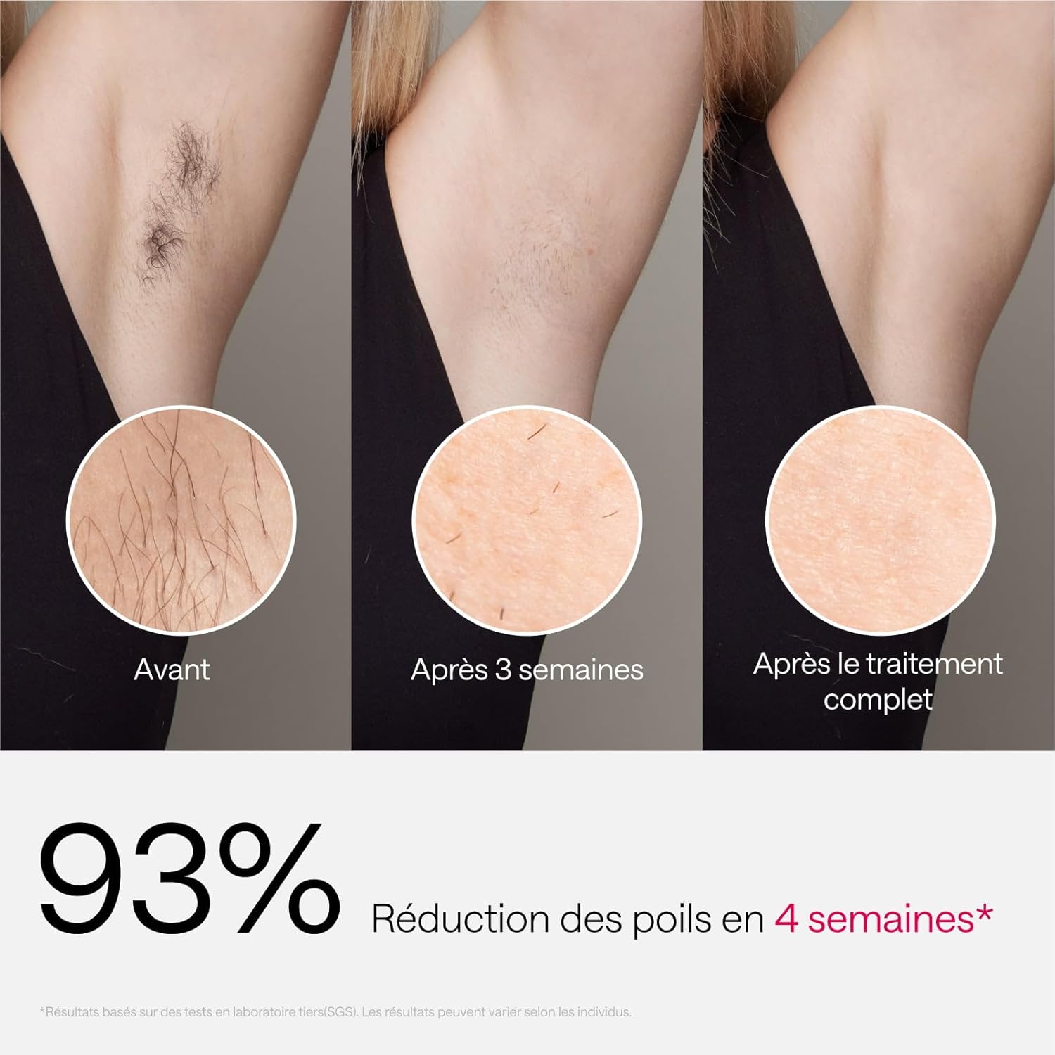 Ulike Air 3 Épilateur IPL pour les Femmes & Hommes – Épilation Laser avec Sapphire Ice Cooling, Résultats Durables et Presque Indolores, Tête Plate pour Corps et Visage, Violet