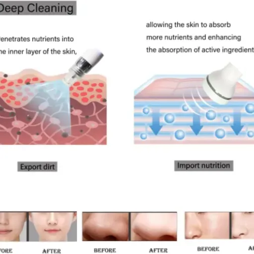 Test Générique 6 in 1 Facial Massage Tool : la machine hydrafacial maison qui veut jouer dans la cour des pros